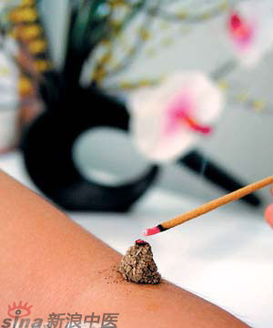 節(jié)氣灸” 冬至，你灸了嗎？