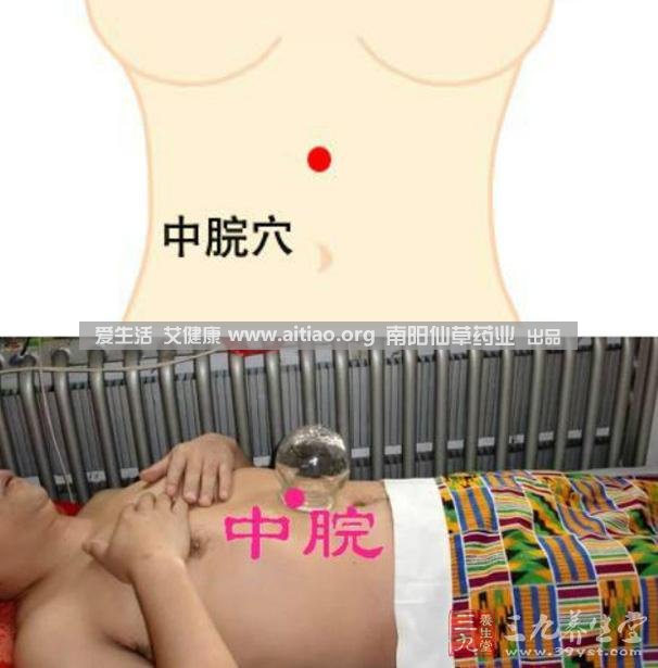 中脘穴位于腹部正中線(xiàn)，臍上4寸的位置上。每天艾灸10-15分鐘，能有效緩解胃部不適的癥狀，同時(shí)有助于祛濕。